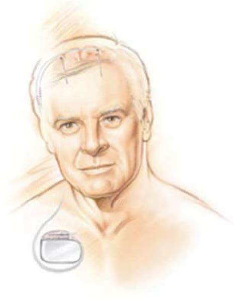 Brain-Stimulating Machine 的图像结果