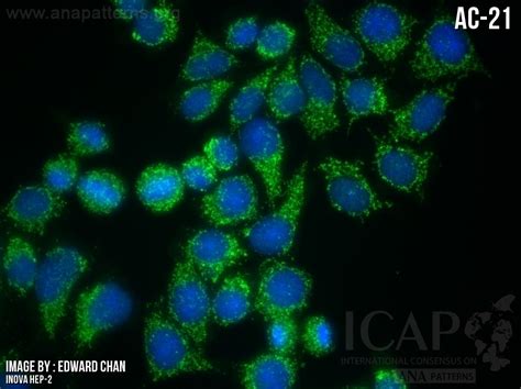 Image result for Ana Pattern Screen