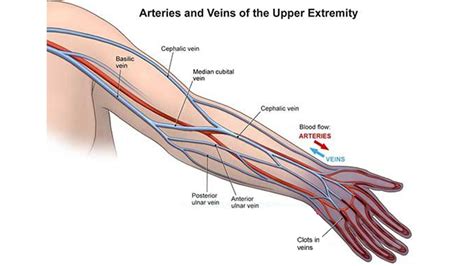 Health Insight Journal | Arteries and veins, Basic anatomy and physiology, Diagnostic medical ...