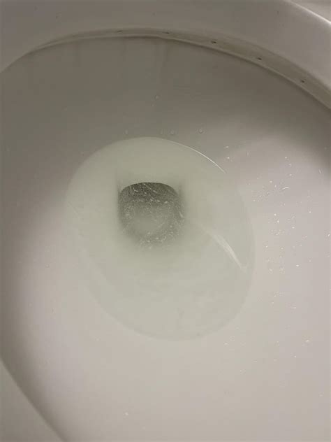 Recent cloudy pee? : r/kidney