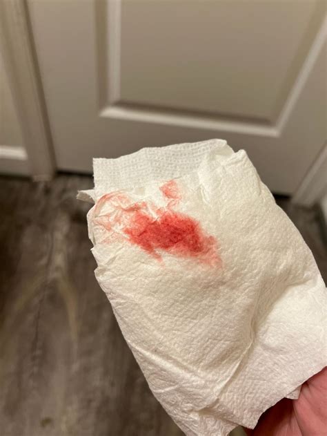 Implantation Bleeding Colour