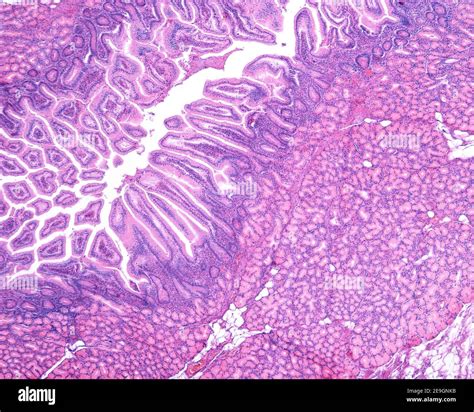 Crypts Of Lieberkuhn Duodenum