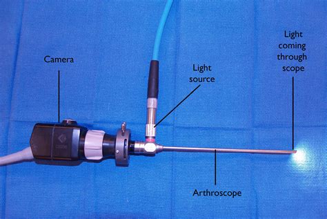 Arthroscopy - OrthoInfo - AAOS