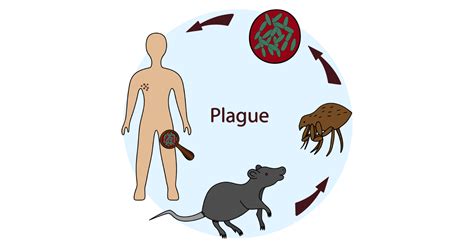 Plague Period Definition at Terri Kent blog