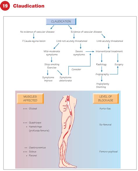 What Is Claudication