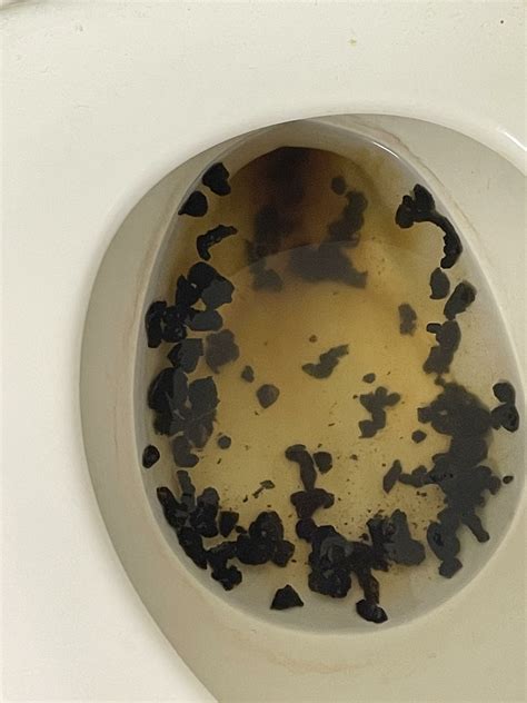 Dream Meaning of Black Stool