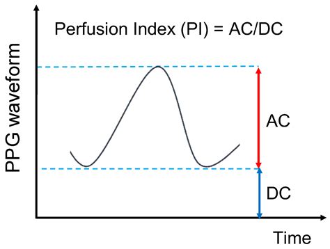 Image result for Measuring SpO2