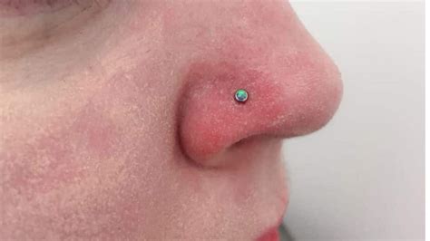 Signs of Infection vs. Normal Healing in Nose Piercings - Piercing Jewelry Manufacturer offers ...