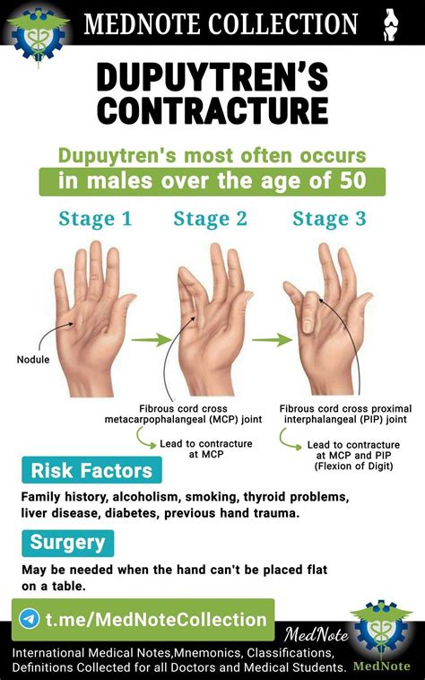 Dupuytren’s contracture – Artofit
