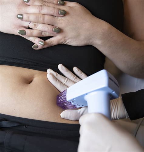 Morpheus8 | Vaginal Rejuvenation | Eagle Mountain | Spanish Fork