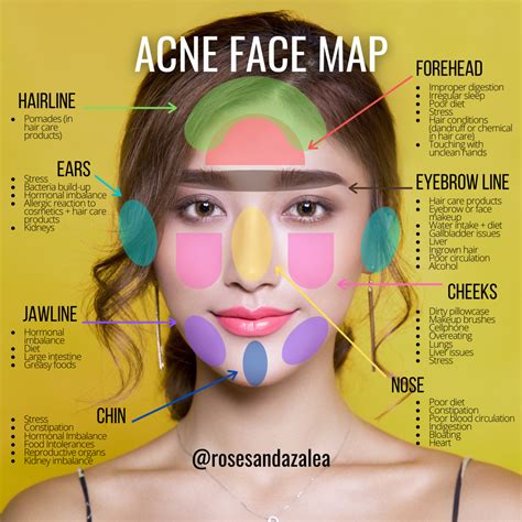 Face mapping your acne – Artofit