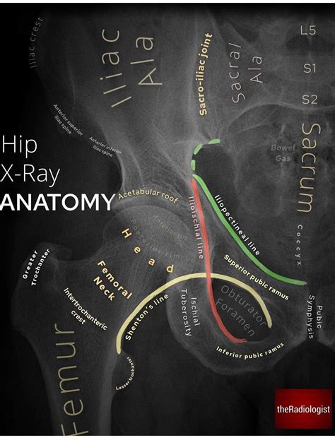Hip X-ray Anatomy - MEDizzy
