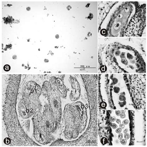 Microsporogenesis and Induction of Unreduced Pollen with High ...