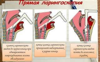 Дисфония: что это, виды, причины, симптомы и лечение