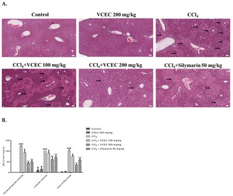 Synergistic Effects of Vitis vinifera L. and Centella asiatica against ...