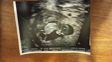 The Bible and pregnancy