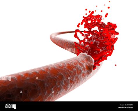 Excoriation hi-res stock photography and images - Alamy