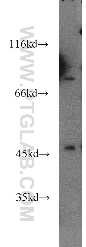 HOXC10 antibody (20632-1-AP) | Proteintech