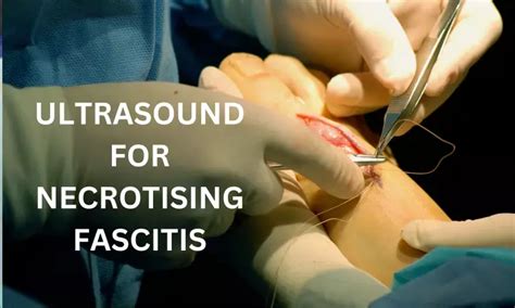 POCUS superior modality for diagnosing Necrotizing fasciitis