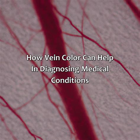 What Color Are Veins - colorscombo.com