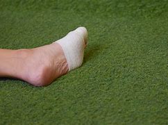 Image result for Injured Feet Pics