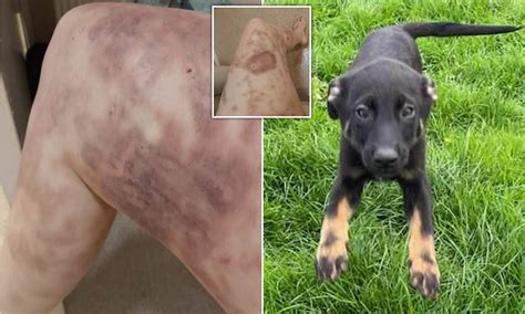 Belgian Malinois Bite