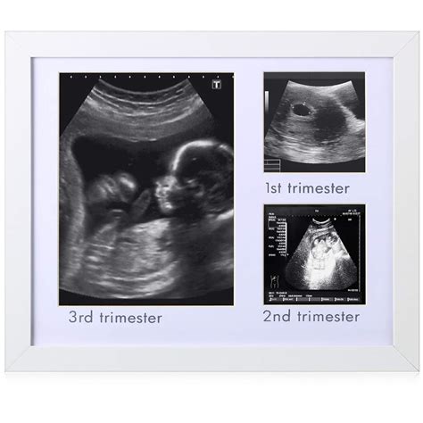 Jetec Pregnancy Ultrasound Picture Frame for Expecting India | Ubuy