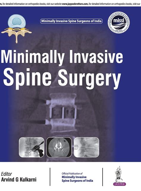 Minimally Invasive Spine Surgery(Official Publication Of Minimally ...
