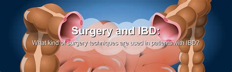 Image result for How to Use IBD