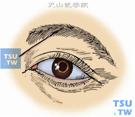 小儿保护视力推拿方法 保护眼睛推拿手法 - 润疗养生网runliao.com