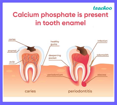 Why Does Calcium Build Up On Your Teeth at Glenn Barbee blog