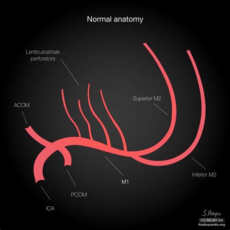 Anterior Cerebral Artery