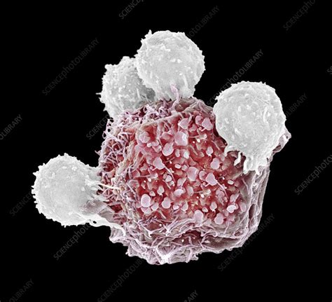 Image result for Lymphocytes Cancer