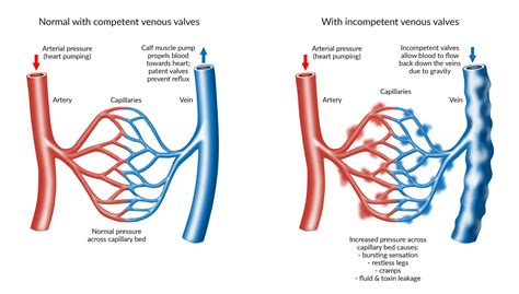 Venous Valves