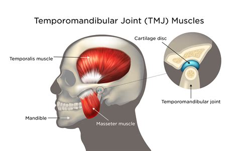 Temporomandibular Joint Disorder (TMJD) | My Doctor Online
