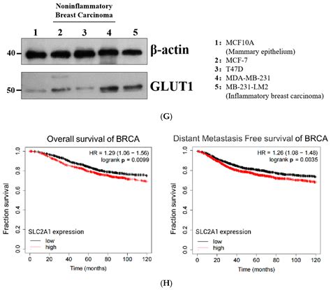 OBHS Drives Abnormal Glycometabolis Reprogramming via GLUT1 in Breast Cancer
