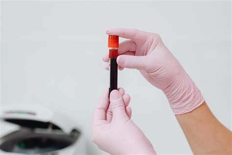 8 Causes of Low RBC Count in Adults (and Ways to Improve it)