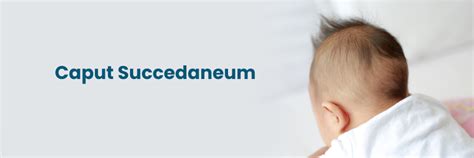 Caput Succedaneum: Sababu na Dalili