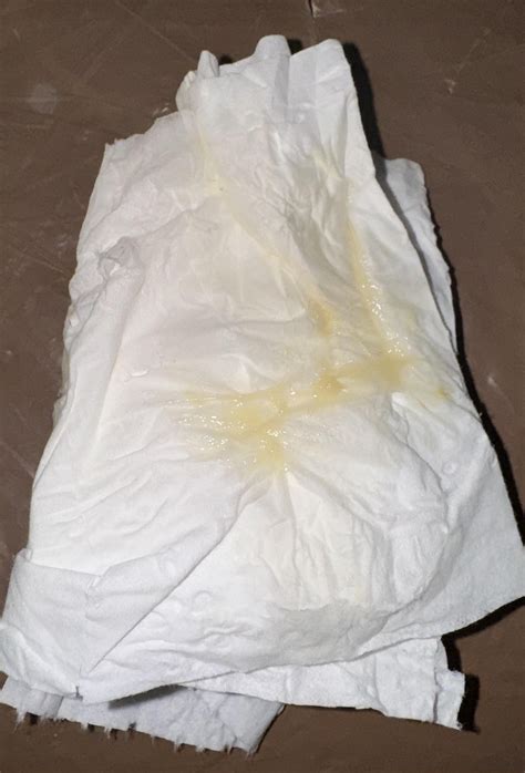 Yellow Discharge Ovulation