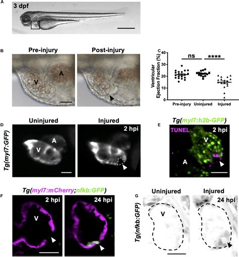 Image result for Zebrafish Embryo Development Heart