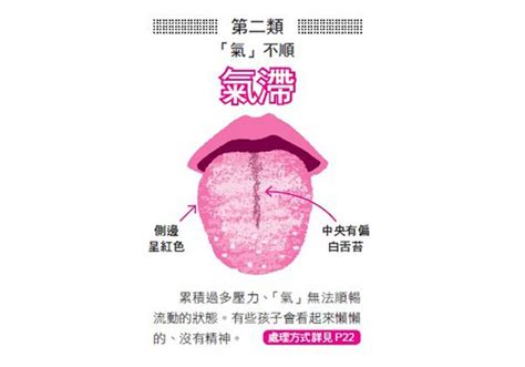 舌頭反應的健康訊息 | Heho健康