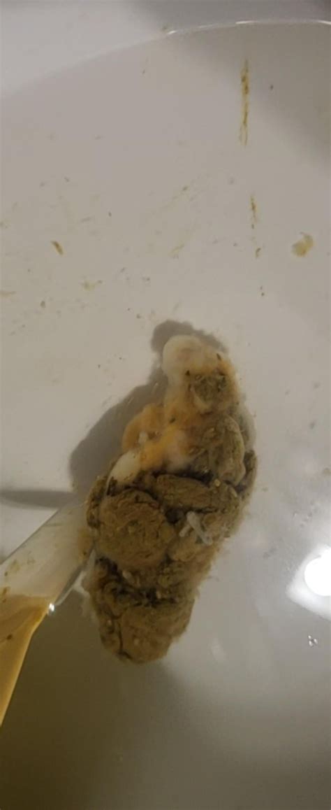 Heavy amount of mucus in stool. Biofilm? : r/biofilms