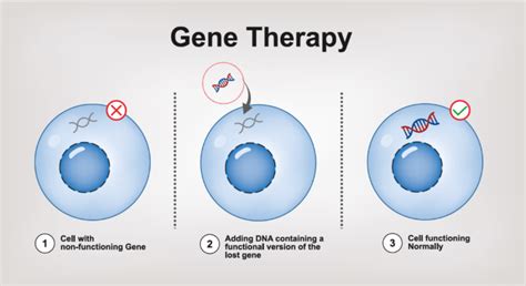 Gene Therapy Investigatory Project PDF class 12: Download Now