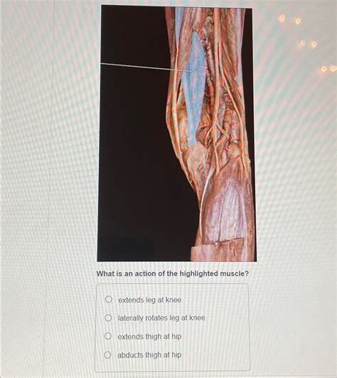 Solved What is an action of the highlighted muscle?extends | Chegg.com