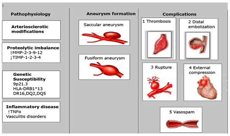 New Insights into the Pathophysiology of Coronary Artery Aneurysms