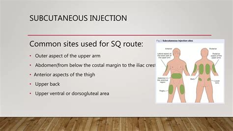 Types of injection | PPTX