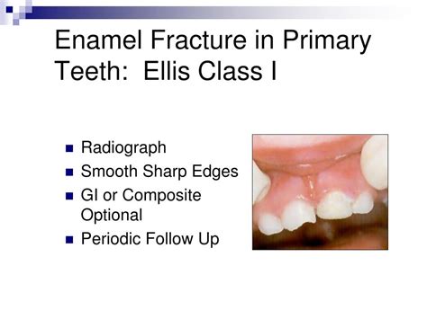 Image result for Graphical Abstract Examples of a Process