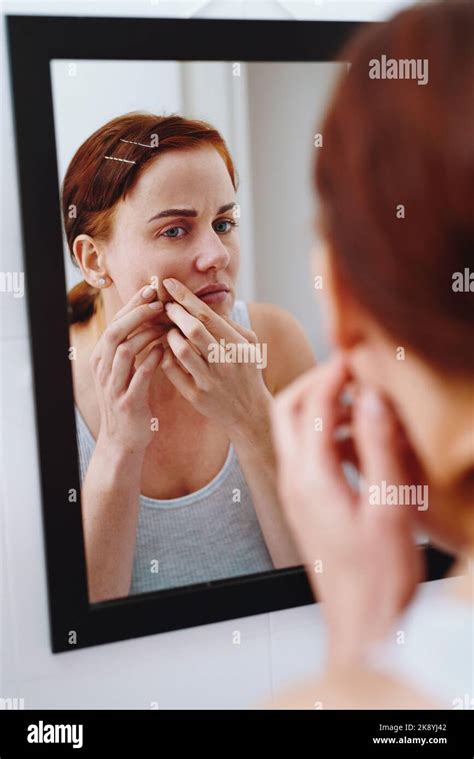 Exploding Pimples 2018 的图像结果