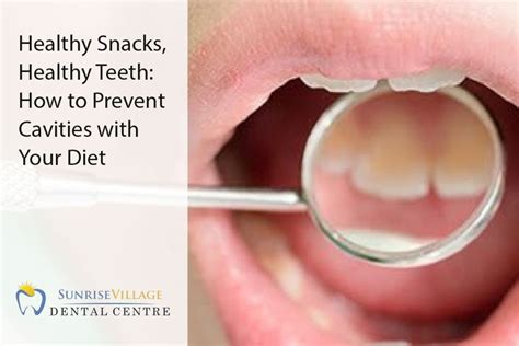 These Foods Can Protect Your Teeth From Cavities, According to Dentists Vector Art