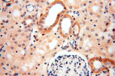 GSNOR,ADH5 antibody (11051-1-AP) | Proteintech